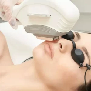 Upper Face / Lower Face Laser Hair Reduction