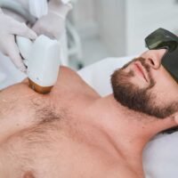 Full Front laser Hair Reduction (Men)